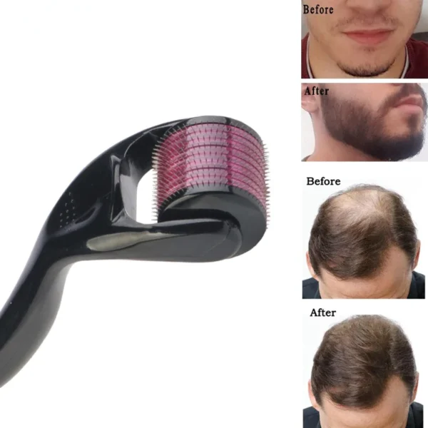 Derma Roller System - Image 3